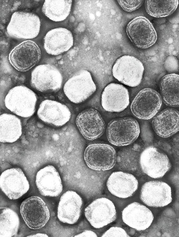 Variola Virus #5 Photograph by Dennis Kunkel Microscopy/science Photo Library