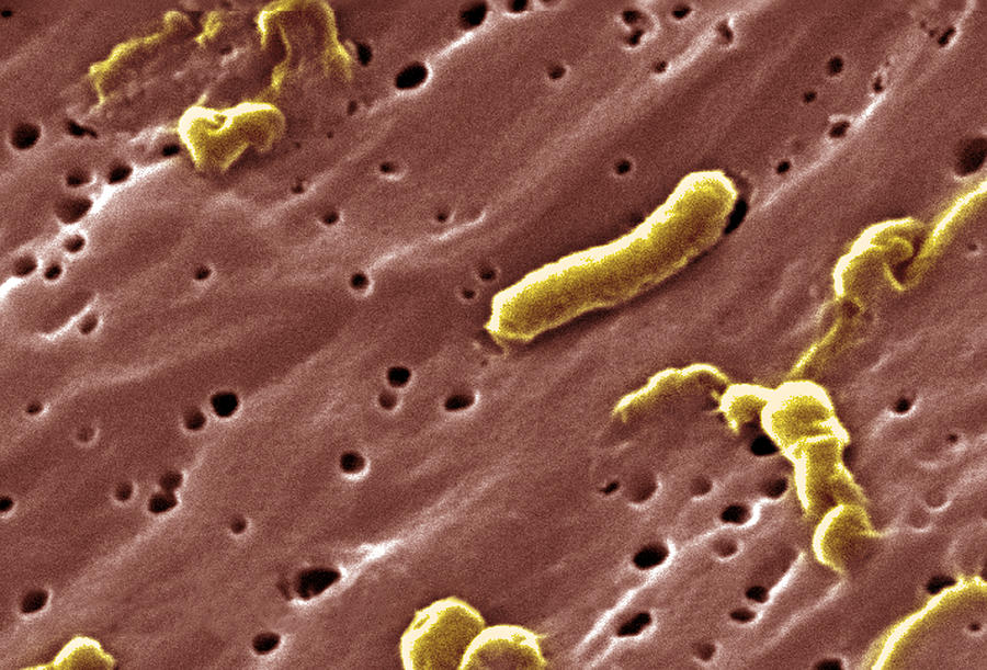 Vibrio Cholerae Bacteria, Sem #5 Photograph by Science Source