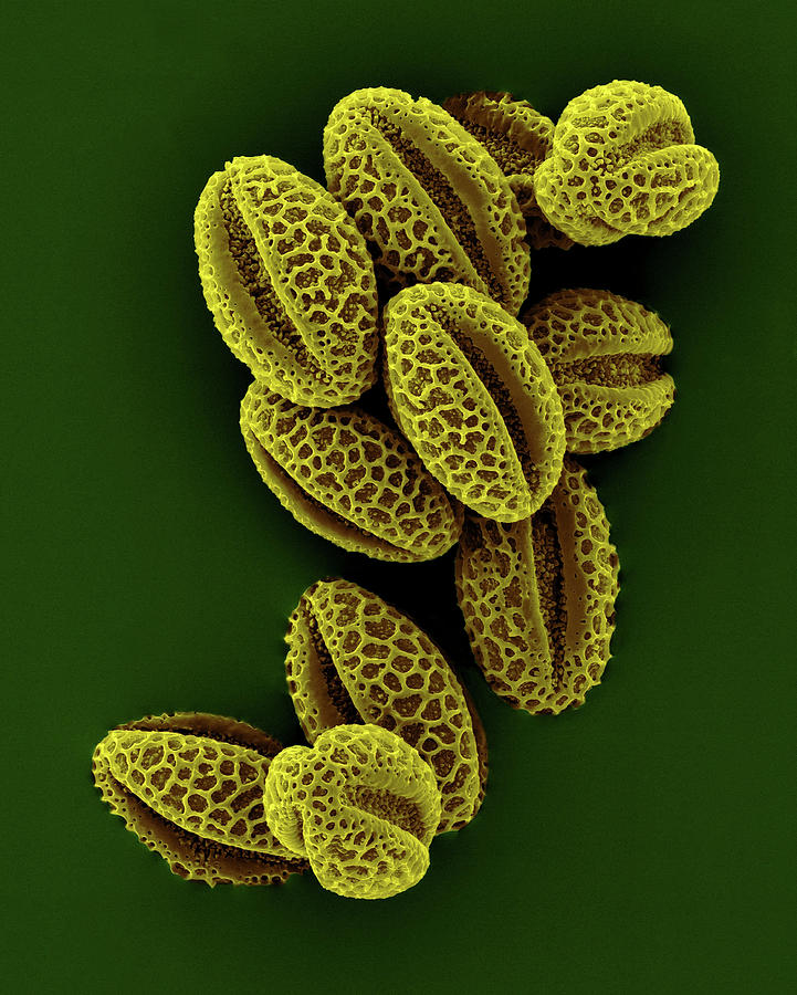 Catkin Photograph - Weeping Willow Pollen (salix Babylonica) #5 by Dennis Kunkel Microscopy/science Photo Library