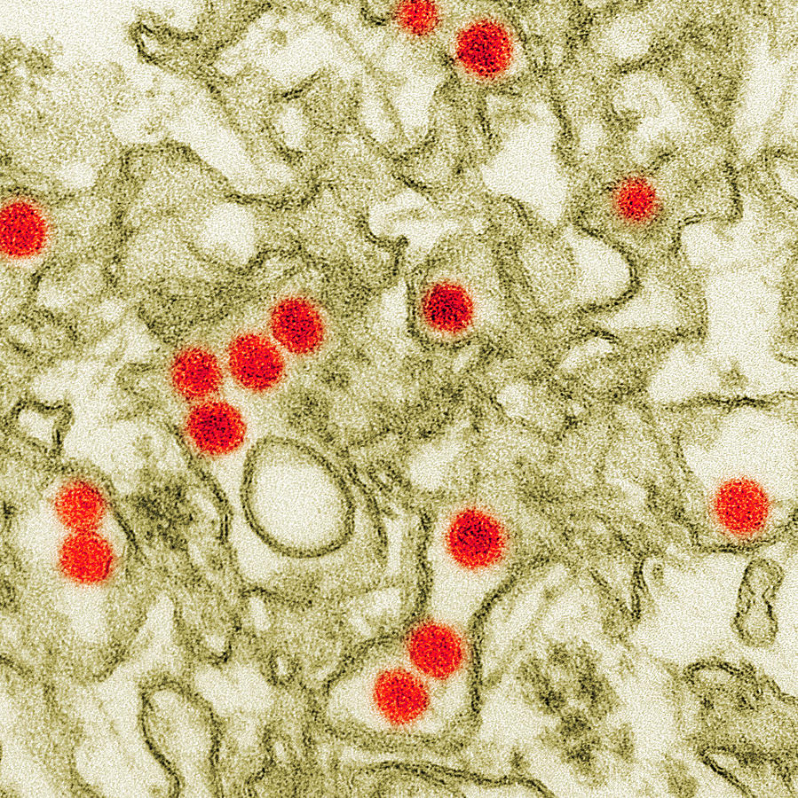 Zika Virus, Tem #5 Photograph by Science Source