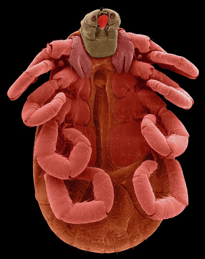 American Dog Tick (dermacentor Variabilis) #6 Photograph by Dennis Kunkel Microscopy/science Photo Library