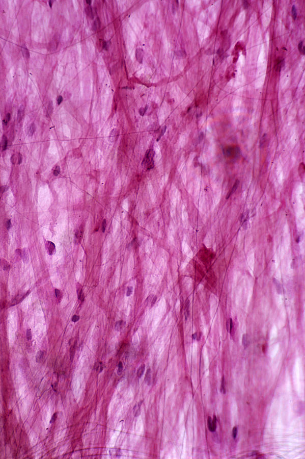 connective tissue areolar