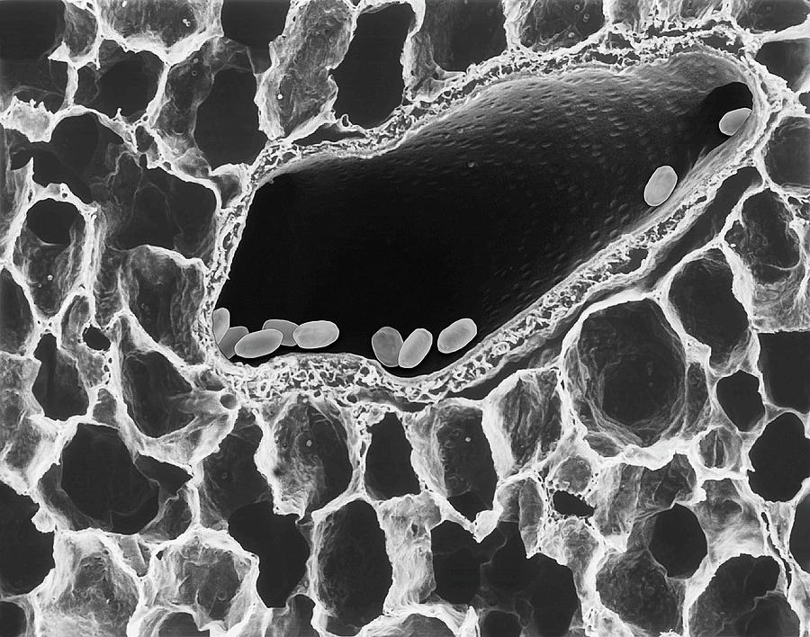 Bacillus Anthracis Spores In Lung Photograph by Dennis Kunkel ...