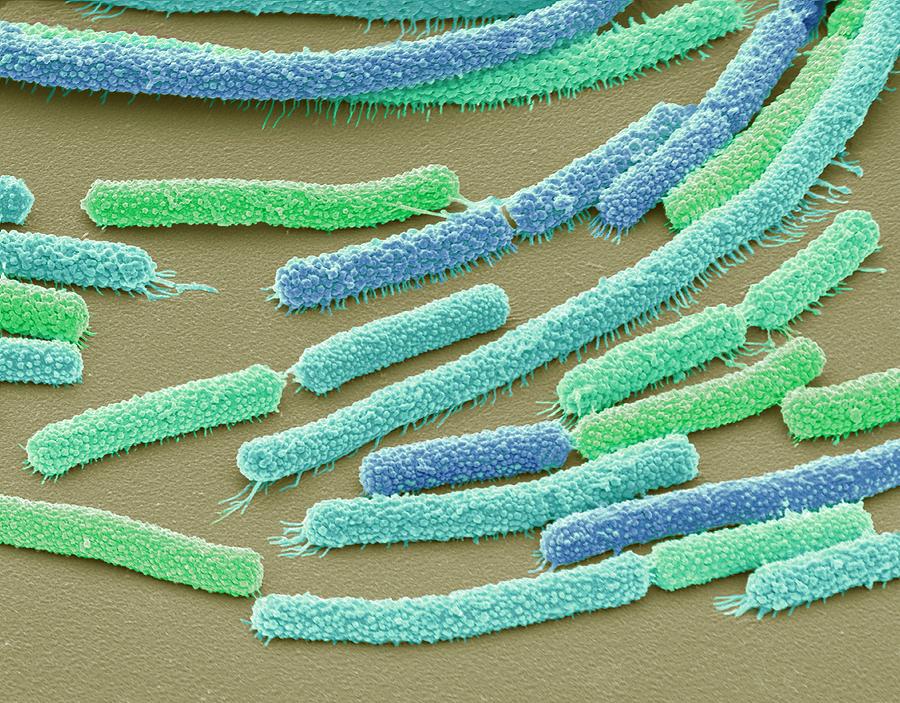 Bacillus Megaterium Bacteria #6 by Steve Gschmeissner/science Photo Library