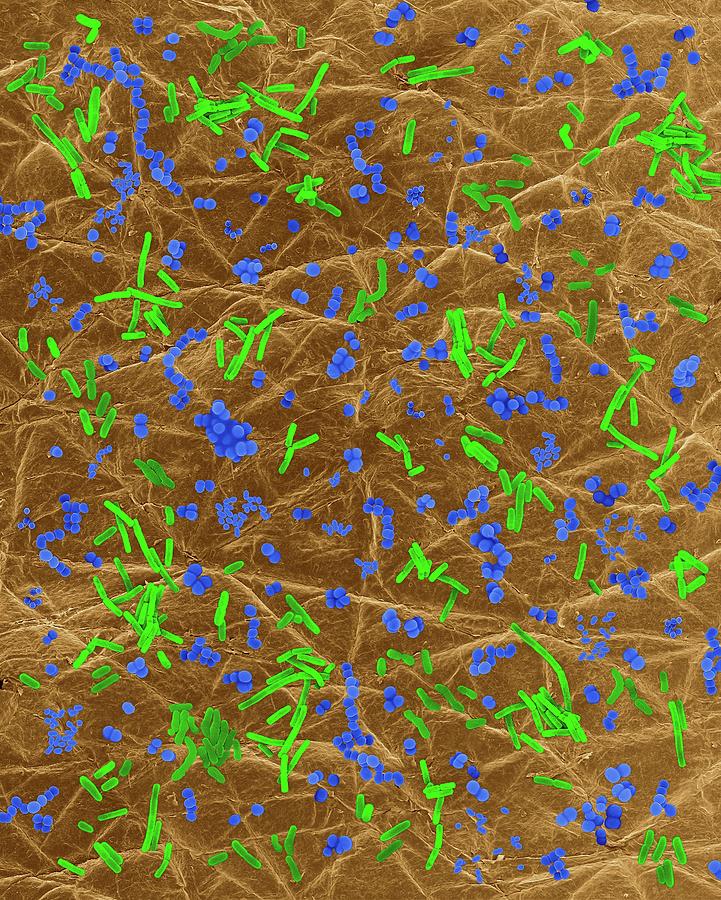 Bacteria On Human Skin Photograph by Dennis Kunkel Microscopy/science