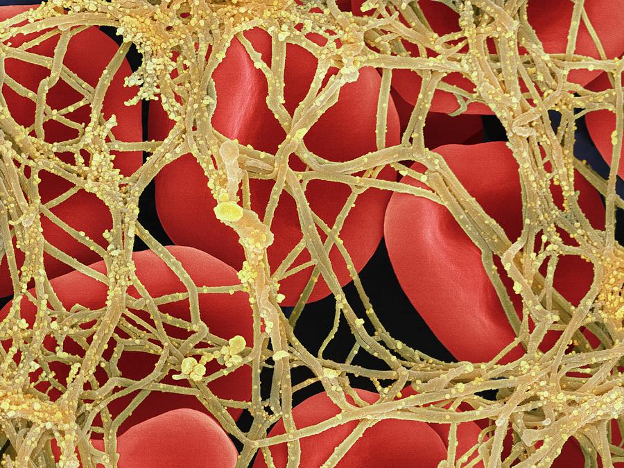 period blot clots period blot clots