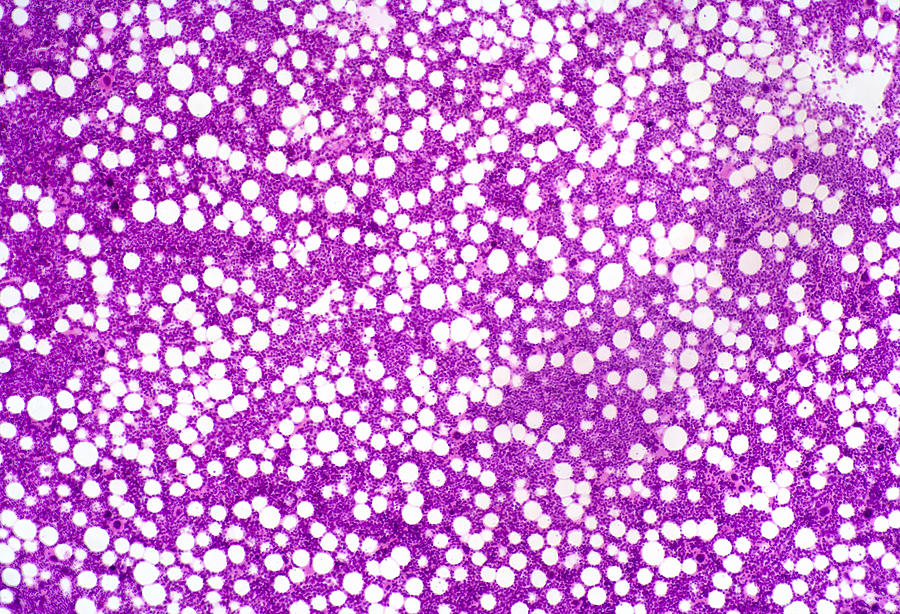 Bone Marrow Section, Lm #6 Photograph by Science Stock Photography