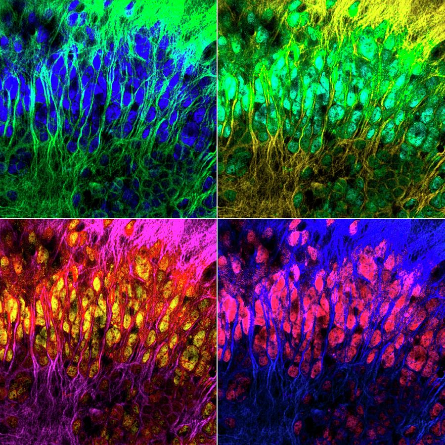 Brain Cells #6 Photograph by Dr. Chris Henstridge
