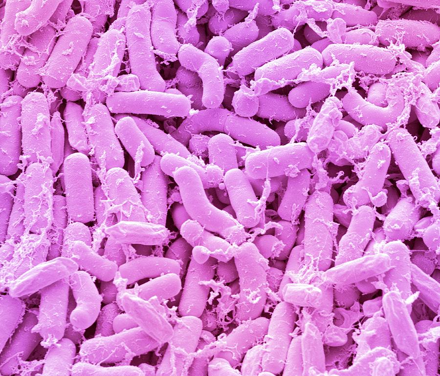 Breast Milk Bacteria #6 Photograph by Steve Gschmeissner/science Photo Library