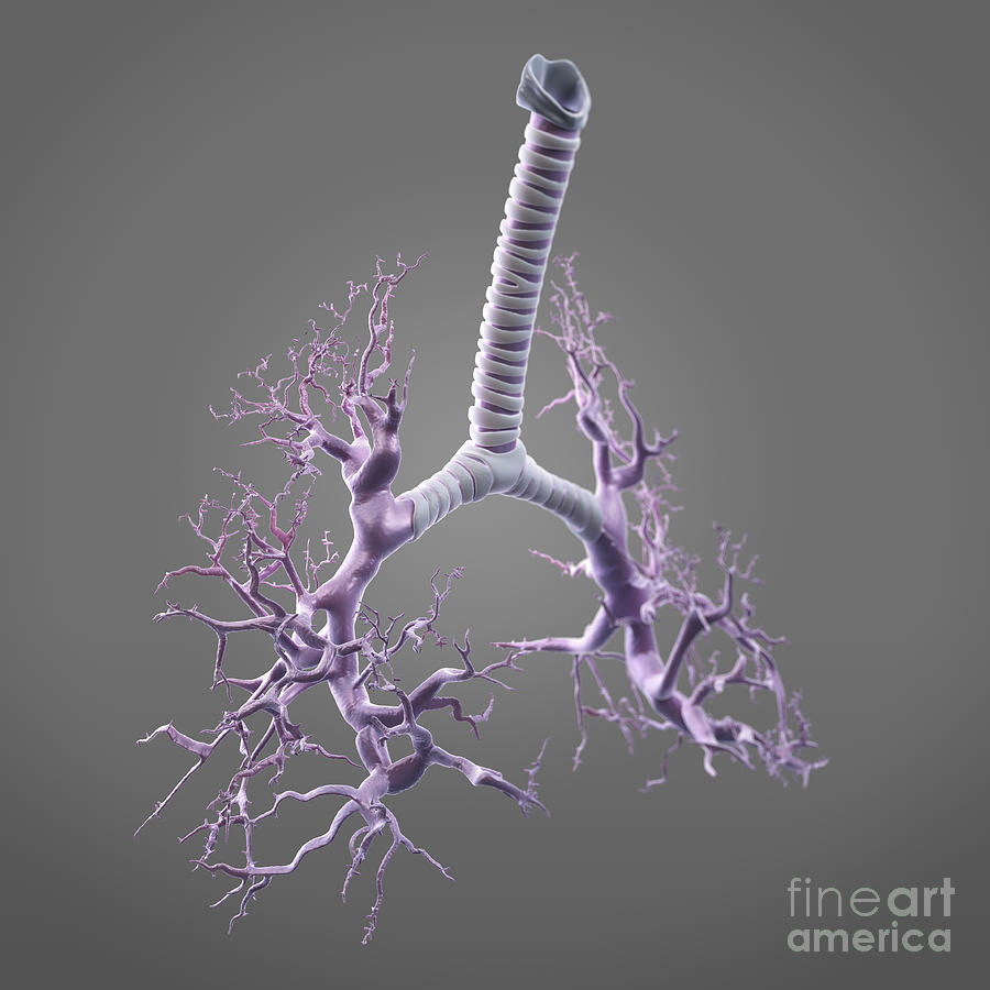 Bronchial Branches #6 Photograph by Science Picture Co
