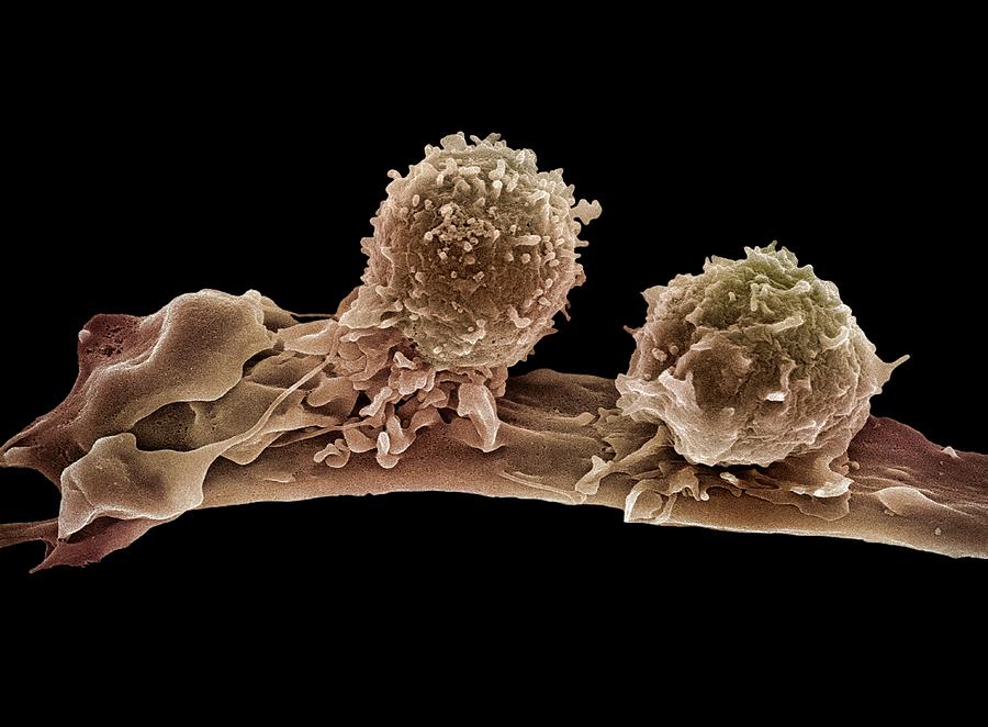Cancer Cell And T Lymphocytes #6 Photograph by Steve Gschmeissner
