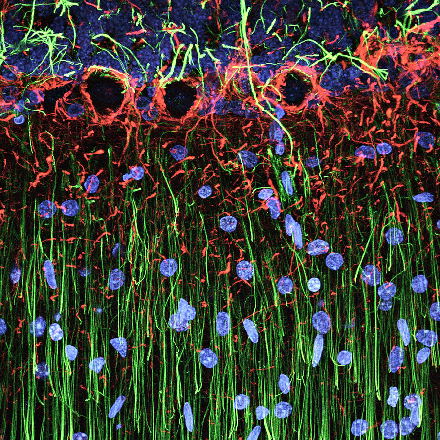 Cerebellum Tissue Photograph By C J Guerin Phd Mrc Toxicology Unit Science Photo Library