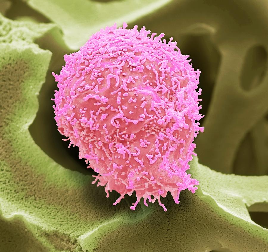 Cervical Cancer Cell #6 Photograph by Steve Gschmeissner