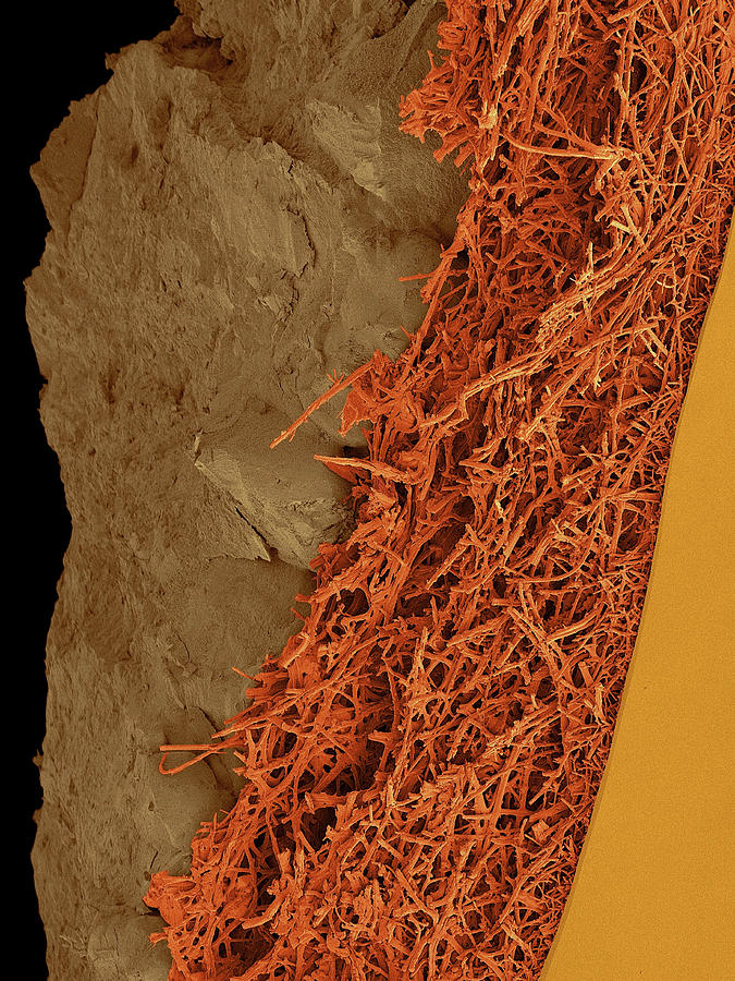 Chicken Eggshell Cross Section #6 Photograph by Dennis Kunkel Microscopy/science Photo Library