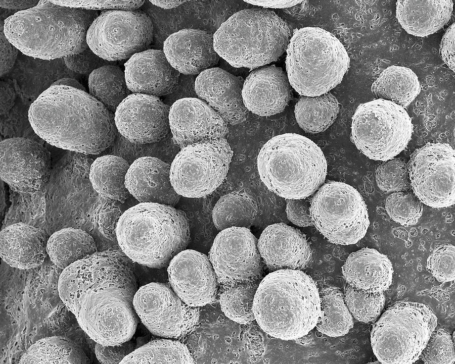 foliose lichen under microscope