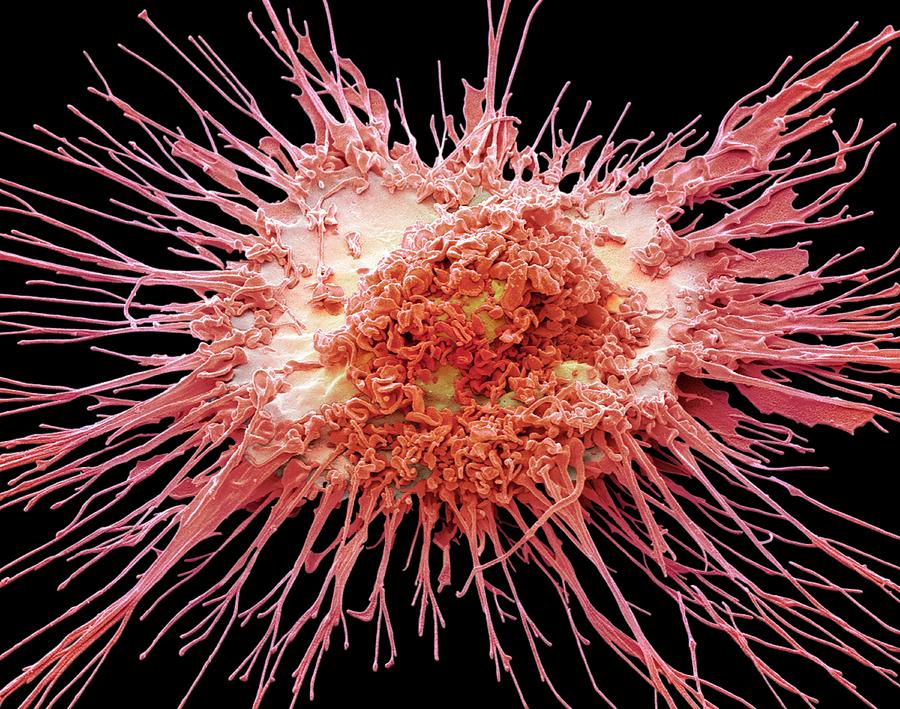 Dendritic Cell #6 Photograph by Steve Gschmeissner