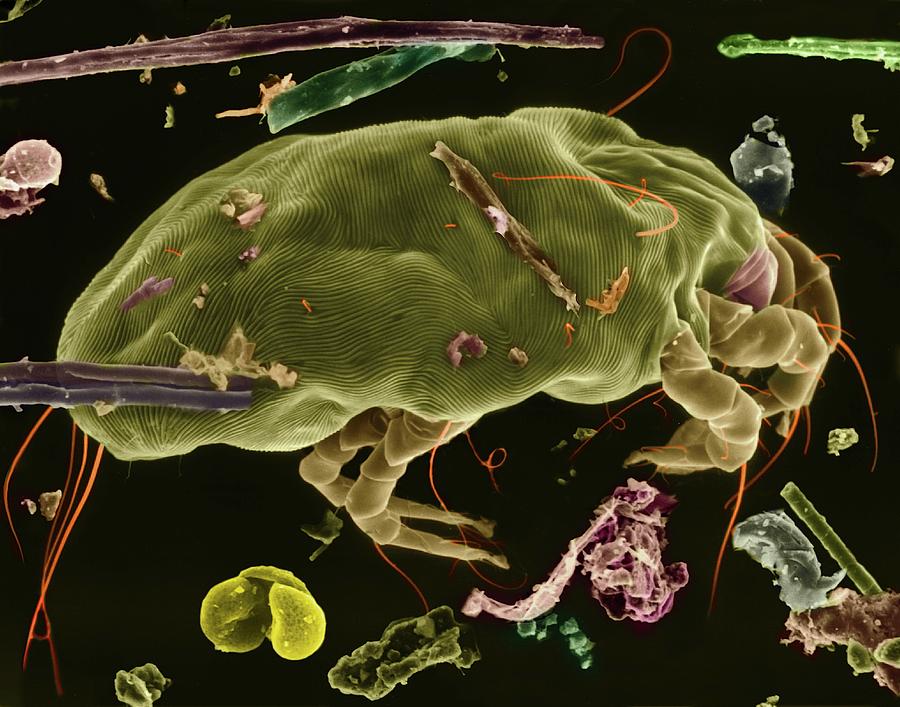 Dust Mite #6 Photograph by Dennis Kunkel Microscopy/science Photo Library