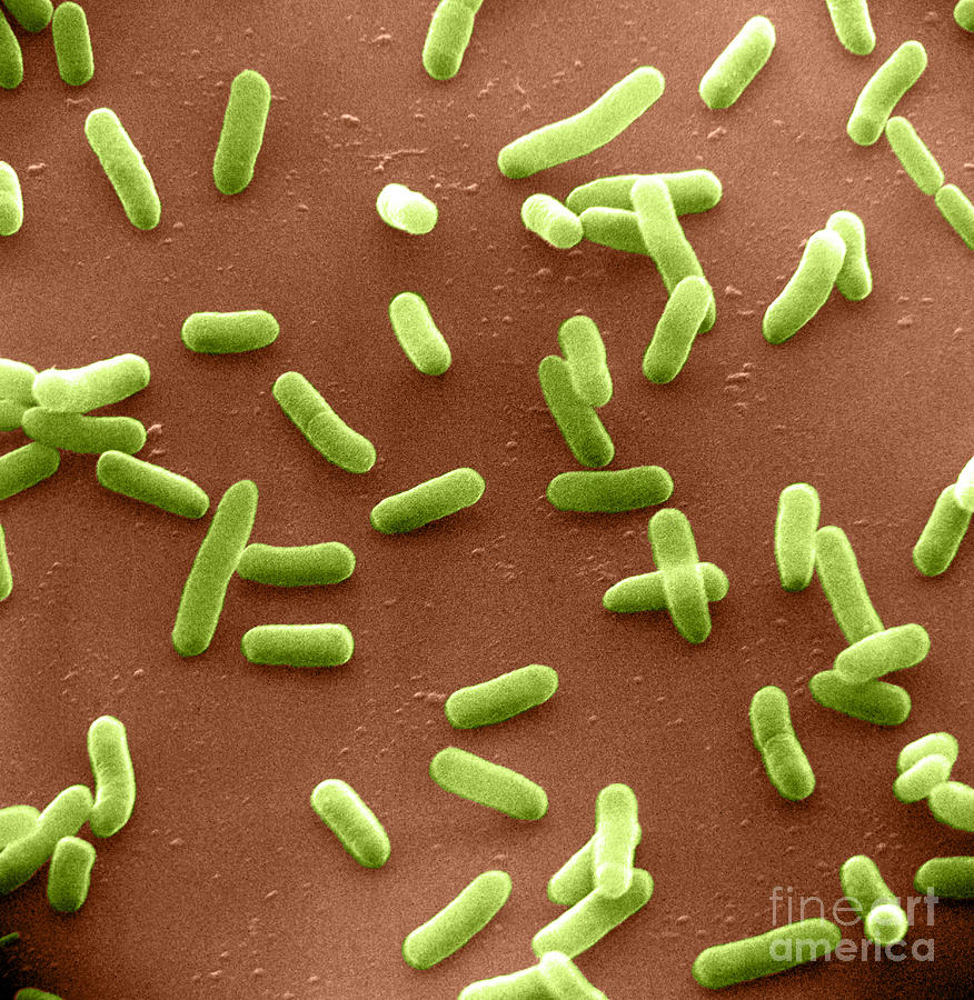 E. Coli Bacteria, Sem #6 Photograph by David M. Phillips