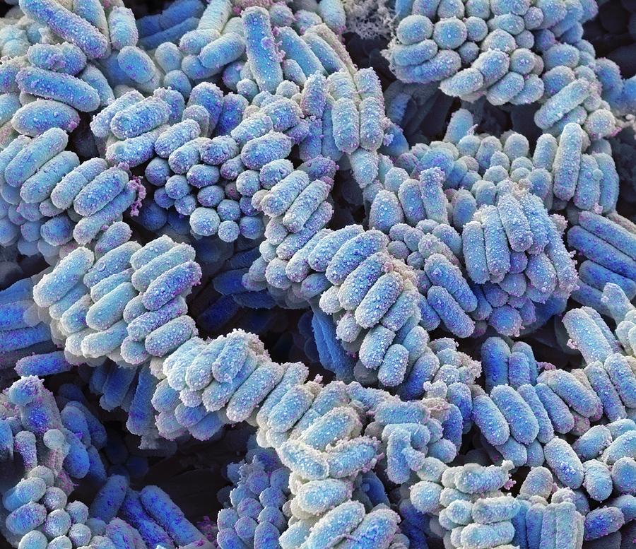 Escherichia Coli Photograph - E. Coli Bacteria #6 by Steve Gschmeissner
