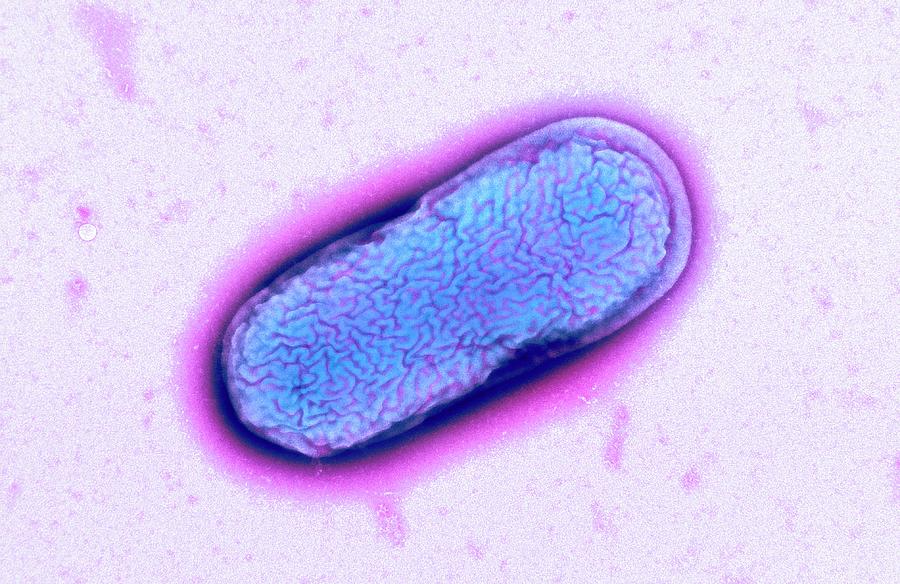 E. Coli O55 Bacterium Photograph by Centre For Infections/public Health ...