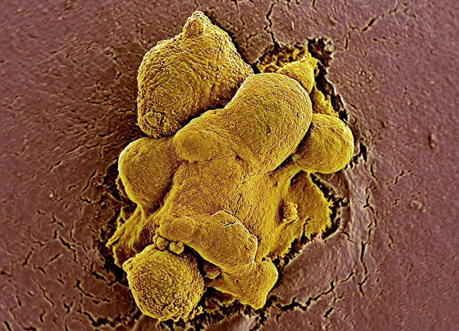 Embryonic Stem Cells #6 Photograph by Professor Miodrag Stojkovic/science Photo Library