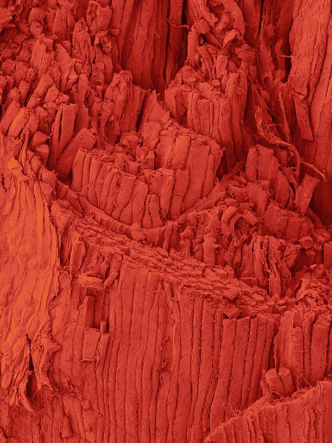 Ham Shank Muscle Fibres #6 Photograph by Dennis Kunkel Microscopy/science Photo Library