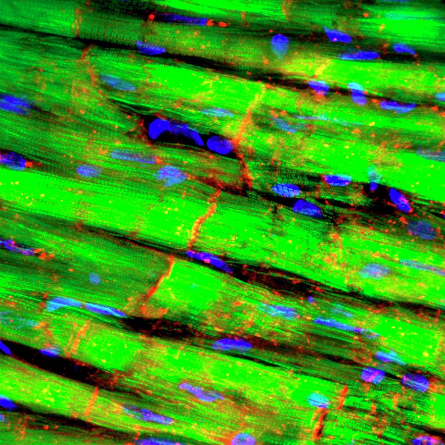 Heart Tissue #6 Photograph by R. Bick, B. Poindexter, Ut Medical School/science Photo Library