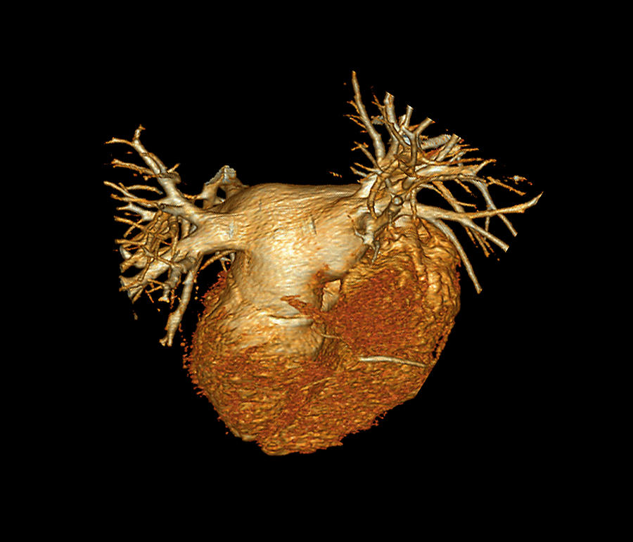 Heart #6 Photograph By Zephyr/science Photo Library - Pixels