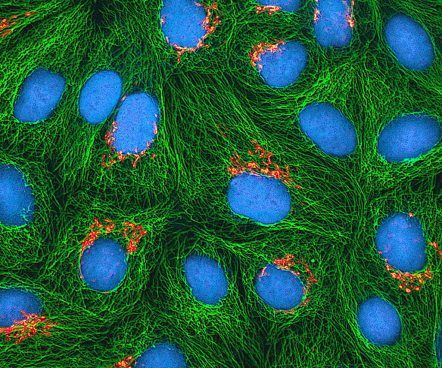 Hela Cells, Mfm #6 Photograph by Science Source