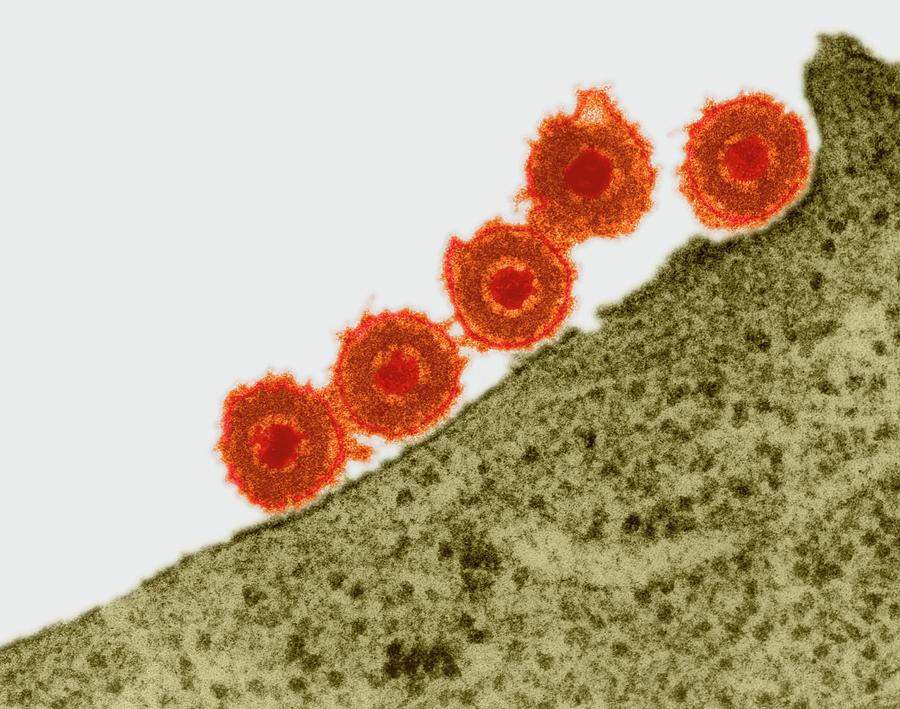 Herpes Simplex Virus #6 Photograph by Dennis Kunkel Microscopy/science Photo Library