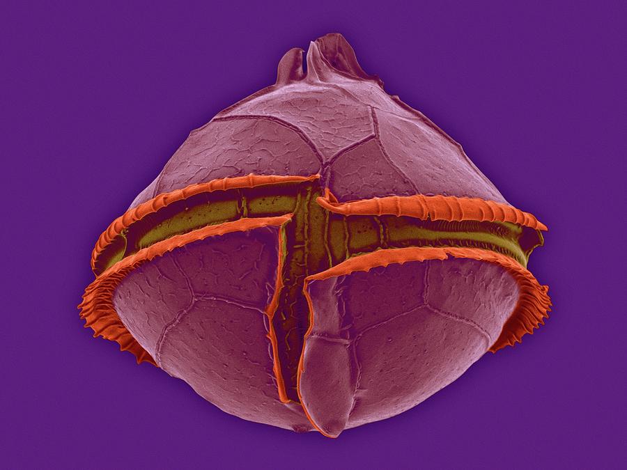 Heterotrophic Dinoflagellate (oblea Sp.) #6 Photograph by Dennis Kunkel Microscopy/science Photo Library