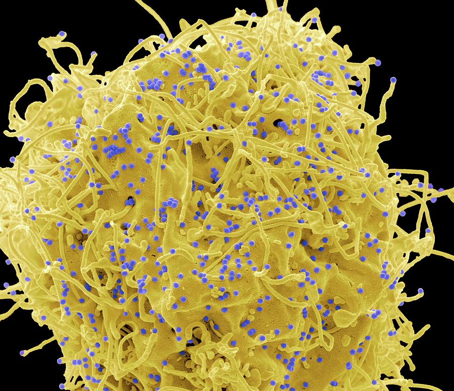 Hiv Infected Cell Photograph by Steve Gschmeissner/science Photo ...