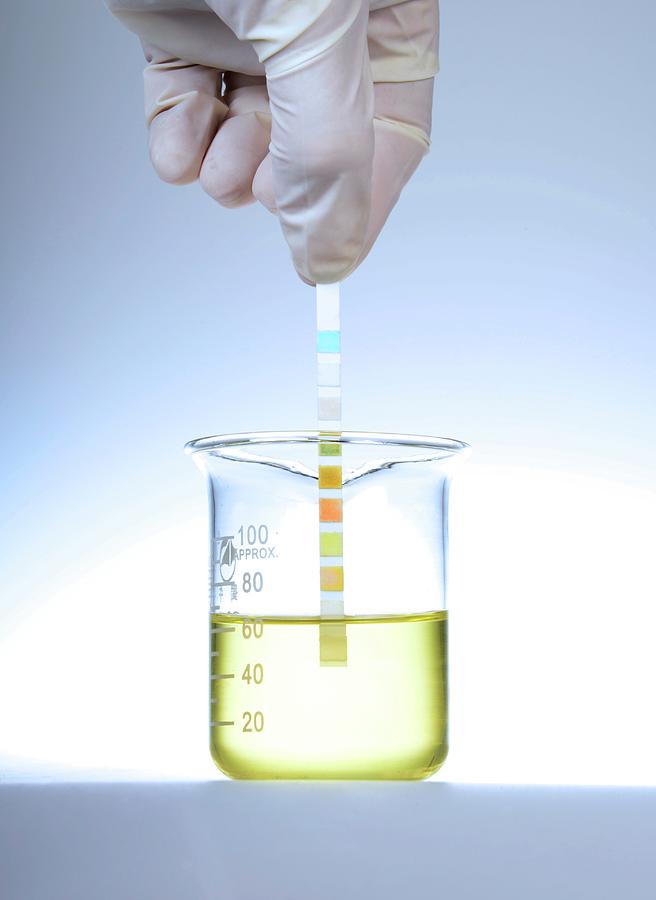 Adult Photograph - Home Urine Test #6 by Cordelia Molloy
