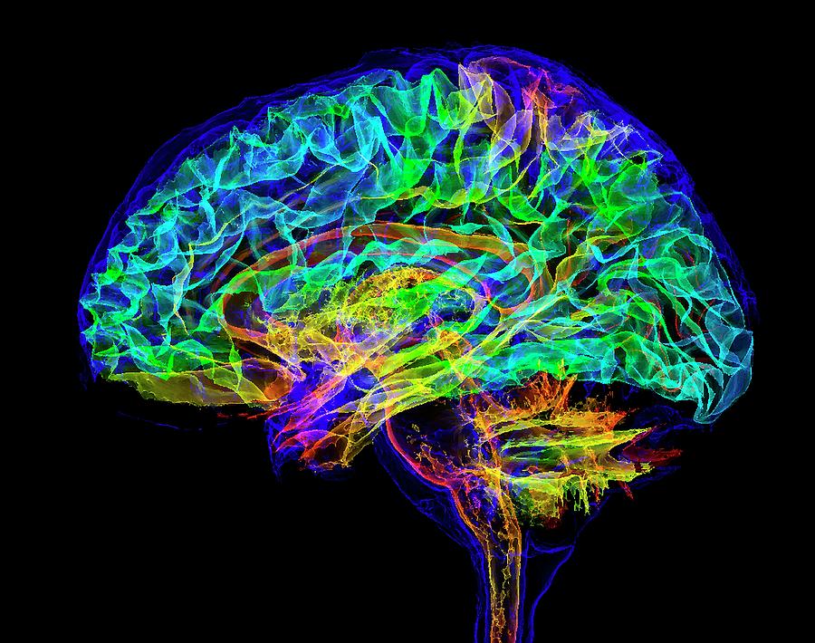 Human Brain Photograph by K H Fung/science Photo Library