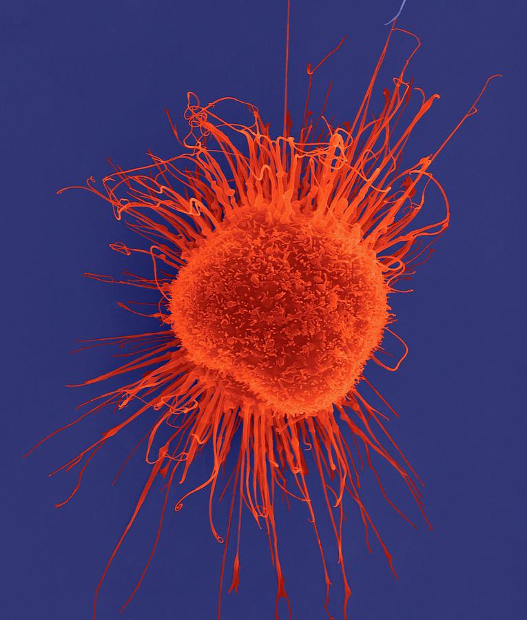 Abnormal Photograph - Human Dendritic Cell #6 by Dennis Kunkel Microscopy/science Photo Library