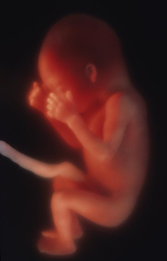 Human foetus in the womb Photograph by Science Photo Library - Fine Art ...