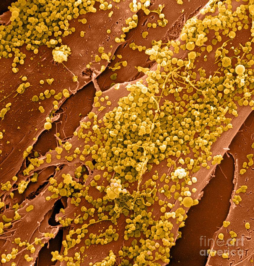 Human Skin Cell Sem #6 Photograph by David M. Phillips