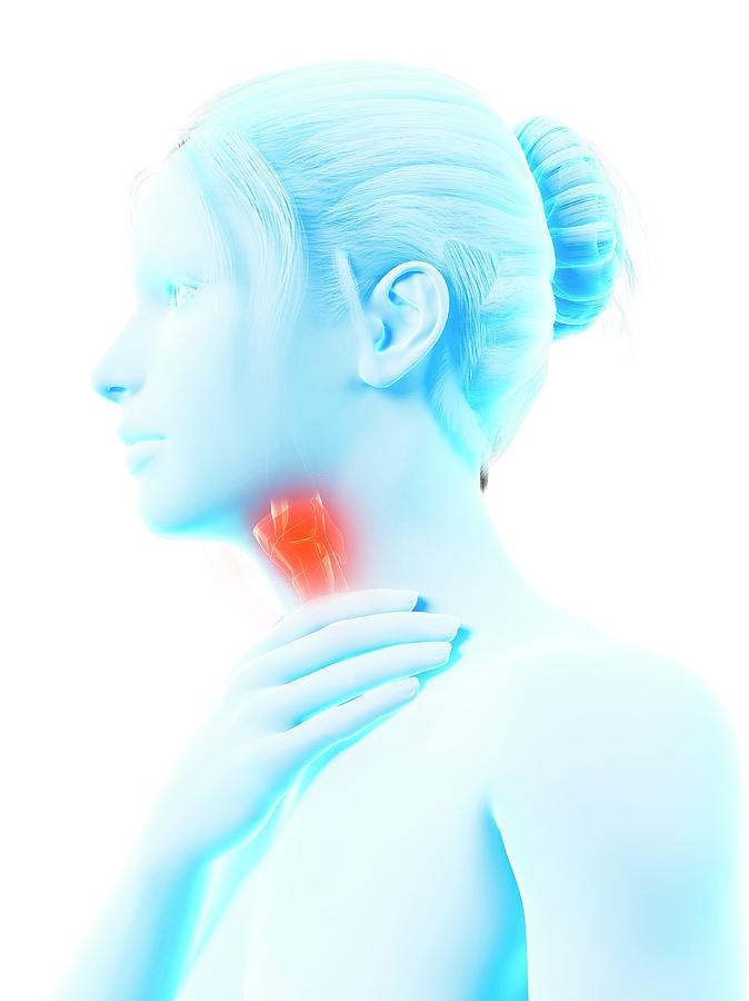 Illustration Photograph - Inflammation Of The Larynx #6 by Sebastian Kaulitzki