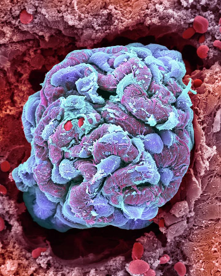 Kidney Glomerulus Photograph by Dennis Kunkel Microscopy/science Photo ...