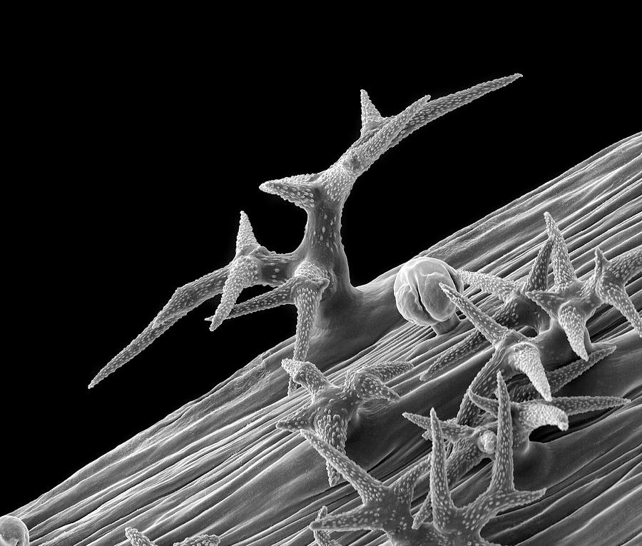 Plant Leaf Trichome (hibiscus Sp.) Photograph by Dennis Kunkel  Microscopy/science Photo Library - Pixels