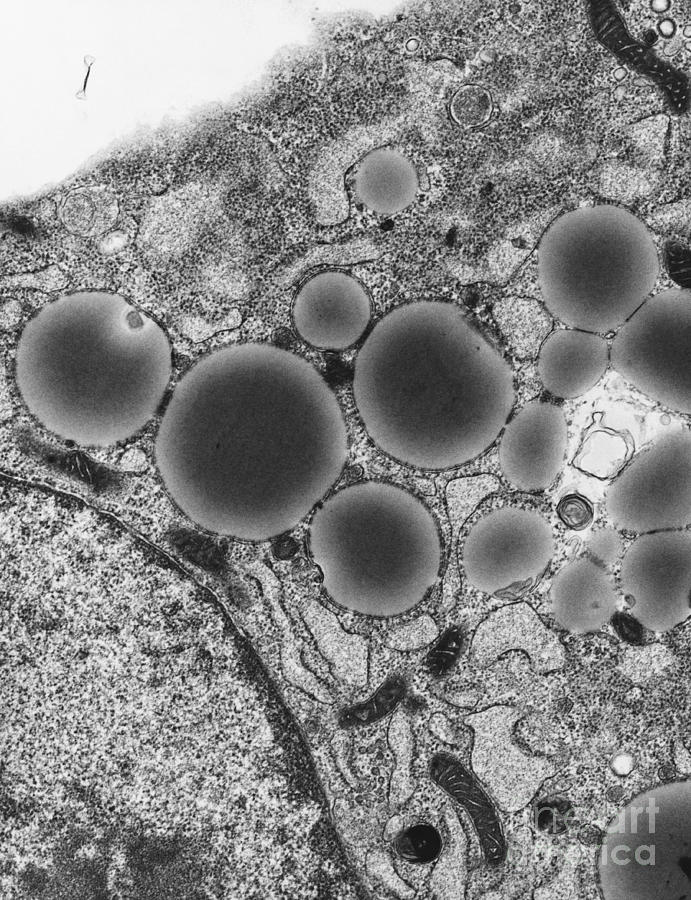 Lipid Droplets Tem #6 Photograph by David M. Phillips