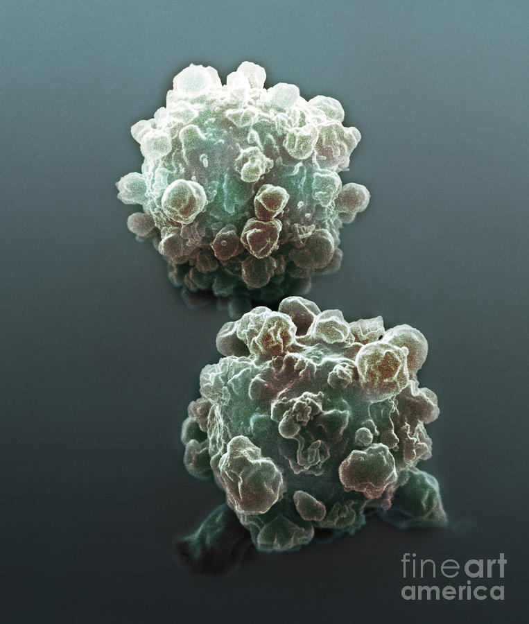 Lymphocytes Undergoing Apoptosis, Sem #6 Photograph by David M. Phillips
