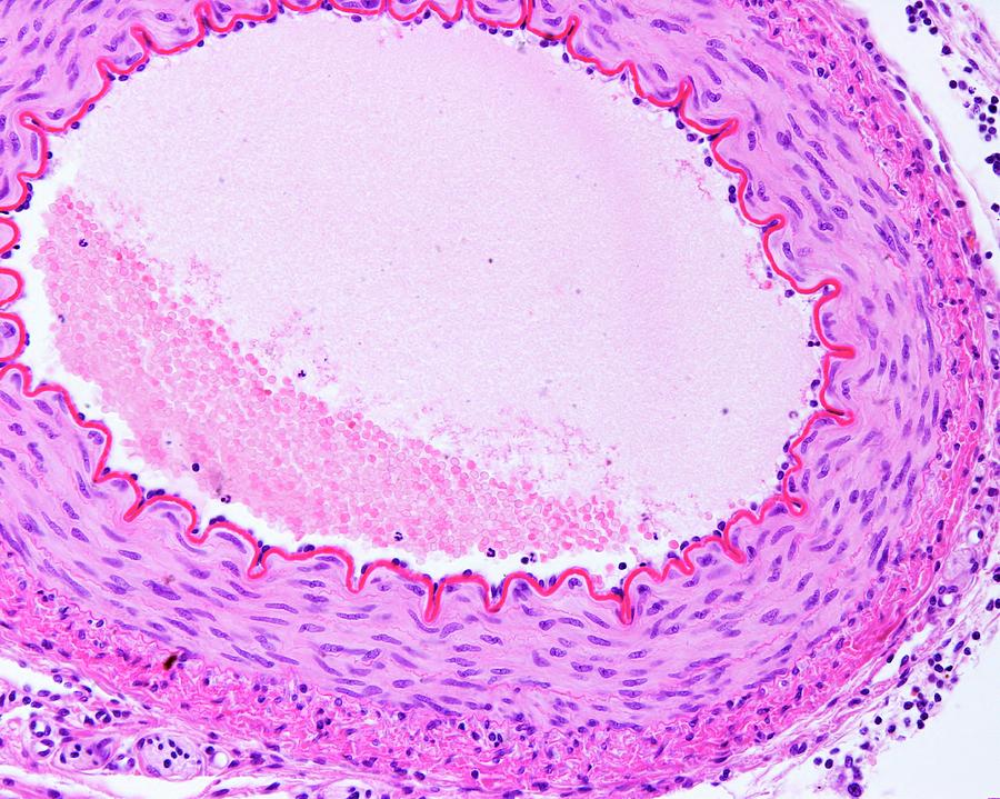 Spiral Artery Histology