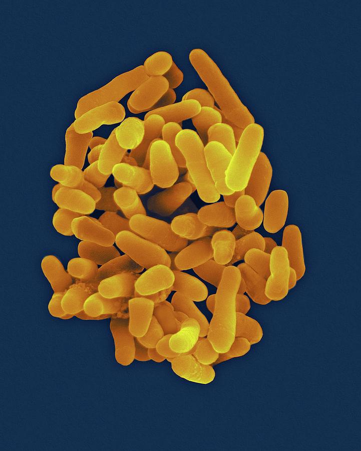 Mycobacterium Tuberculosis #6 Photograph by Dennis Kunkel Microscopy ...