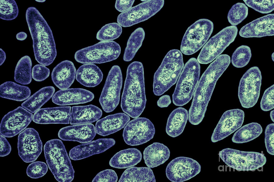 Mycobacterium Tuberculosis #6 Photograph by Kwangshin Kim