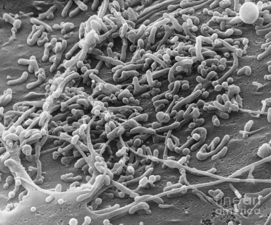 Mycoplasma Bacteria, Sem #6 Photograph by David M. Phillips