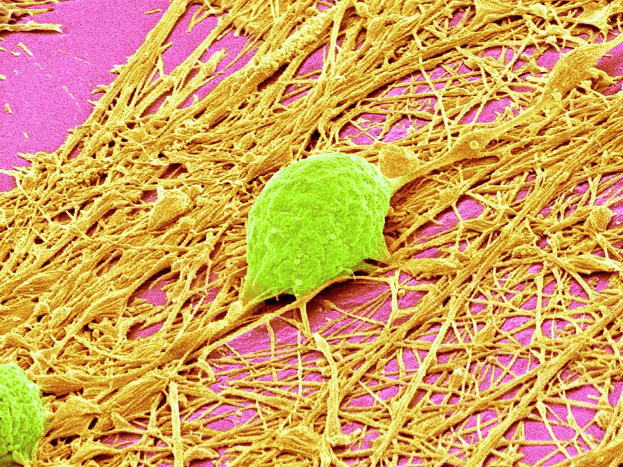 Nervous System Cells #6 Photograph by Susumu Nishinaga