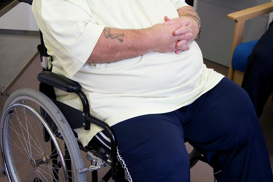 Obesity Clinic Patient Photograph by Life In View/science Photo Library