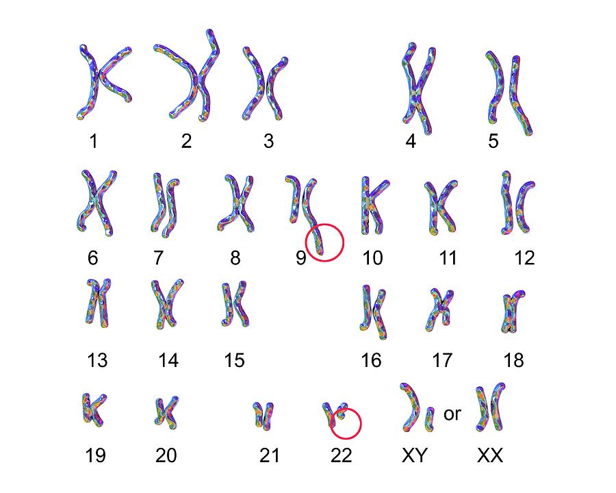Philadelphia Chromosome Photograph by Kateryna Kon/science Photo Library