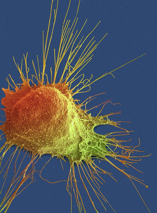 Prostate Cancer Cell #6 Photograph by Steve Gschmeissner